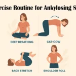 Daily Exercise Routine for Ankylosing Spondylitis